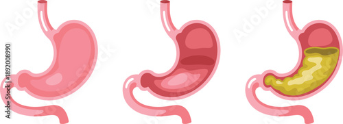 Human Stomach Anatomy Stages of Digestion and Empty Stomach Illustration Keywords: stomach, human, anatomy, digestive system