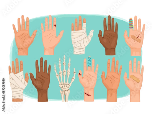 Illustration of diverse hands with various injuries on a teal background