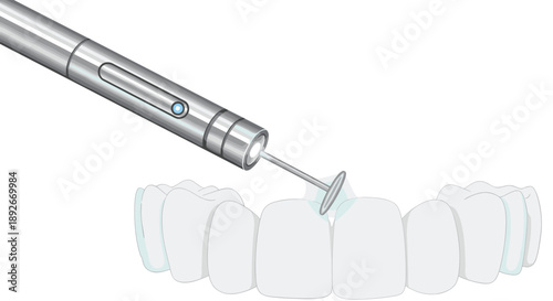 Professional Dental Laser Tool Performing a Procedure on a Tooth with Glowing Blue Light