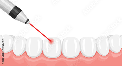 Red Laser Beam Hitting a Tooth in a Set of Gums Representing Modern Dental Laser Therapy