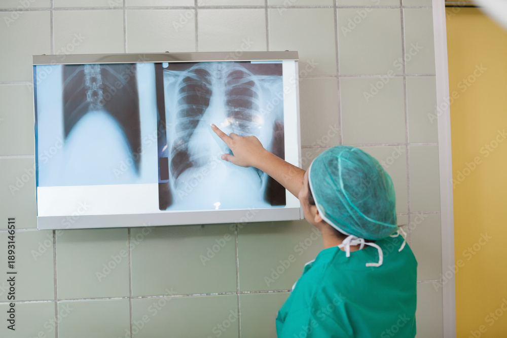 Fototapeta premium Backlit lightbox is displaying chest X-ray films on pale green tiled wall, pale yellow door