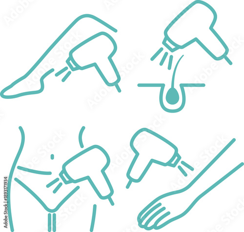Hair Removal Icon Set. Vector Illustration of Laser Treatment for Legs, Arms, Underarms, and VIO