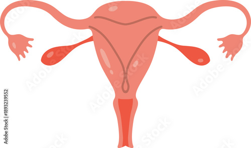 Medical Diagram of Female Reproductive System, Uterus, Ovaries, Fallopian Tubes