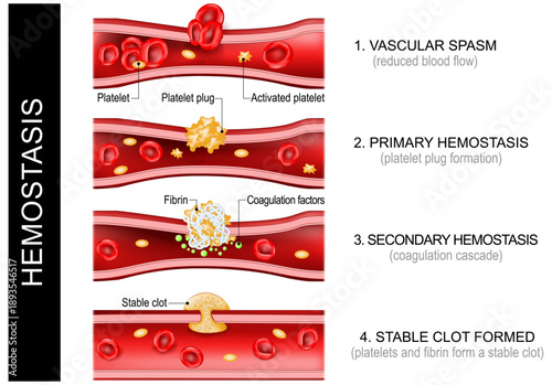 Hemostasis. Wound healing. Platelets and fibrin form a stable clot.
