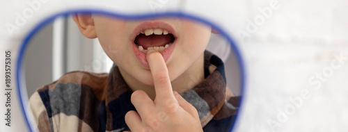 Slika na platnu Little boy looking in the mirror at his loose primary tooth.