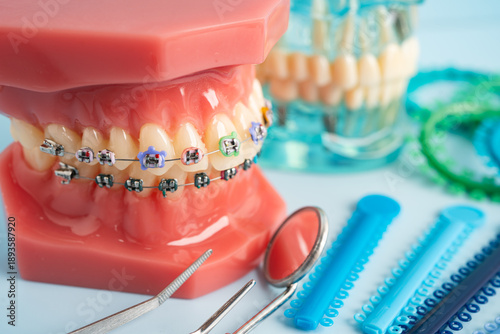 Photos Orthodontic ligatures rings and ties, elastic rubber bands on orthodontic braces, model for dentist studying about dentistry
