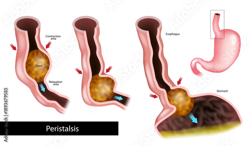 Esophageal Peristalsis Process with Food Bolus Moving Toward the Stomach. Human Digestive System Illustration Showing Esophagus Peristalsis Mechanism