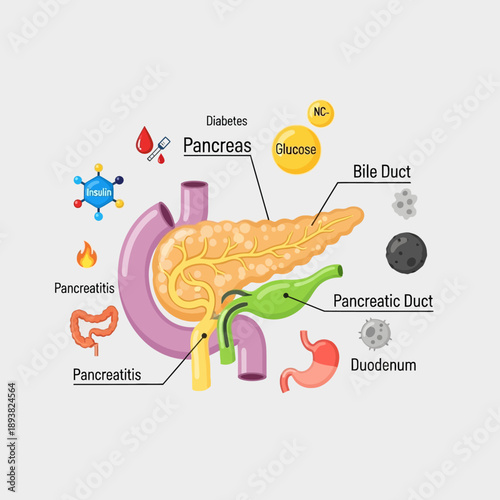 Human Pancreas Anatomy Diagram with Diabetes and Pancreatitis Icons