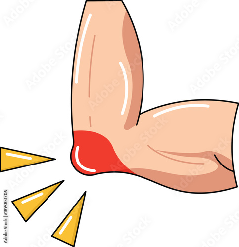 Heel Injury Pain and Bleeding Foot Illustration