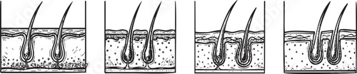 Medical illustration of hair growth stages  and scalp health Vector