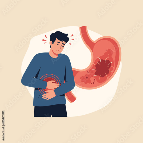 Man with Stomach Pain, Digestive System Illness, Gastric Discomfort
