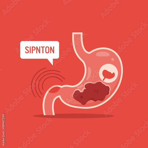 Stomach Ulcer Illustration with Pain Symbol and "Symptom" Text Bubble