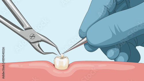 Professional medical scene showing a gloved dentist using various surgical tools to prepare for a tooth extraction from the jaw.