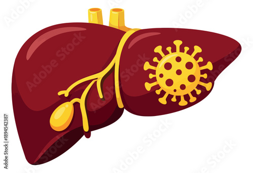 Cartoon style illustration of a human liver depicting a viral infection for medical education