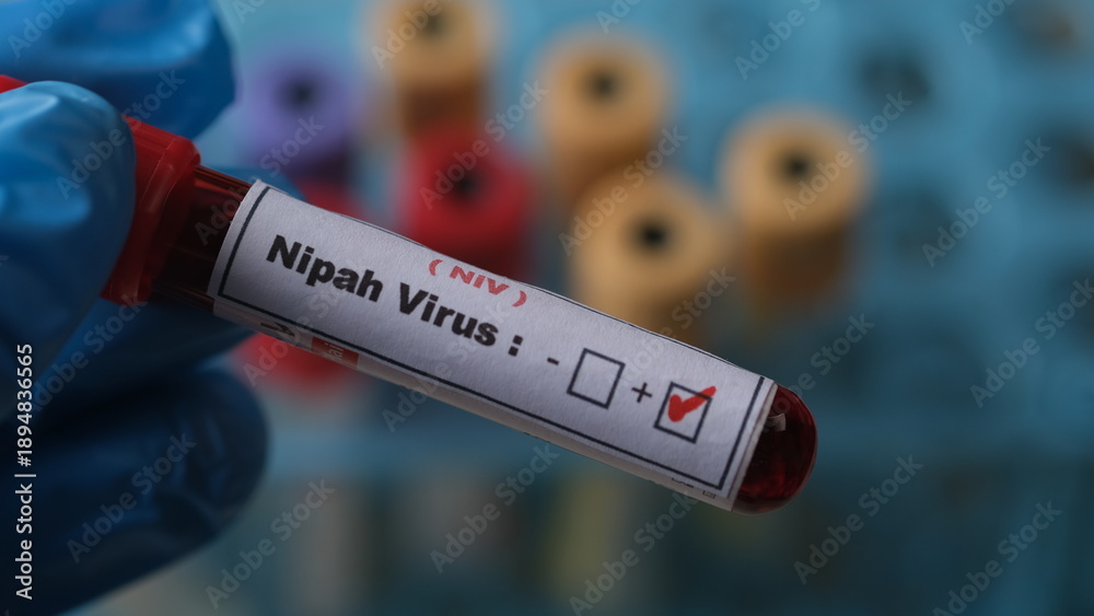 Obraz premium The Nipah virus is a zoonotic virus that primarily affects animals, particularly fruit bats, but can also infect humans and other animals.