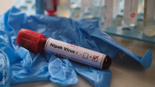The Nipah virus is a zoonotic virus that primarily affects animals, particularly fruit bats, but can also infect humans and other animals.