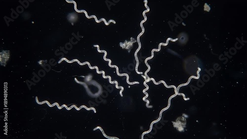 Lyme disease spirochetes floating in a liquid. Microscopic photo of a spirochete of Lyme disease bacteri.