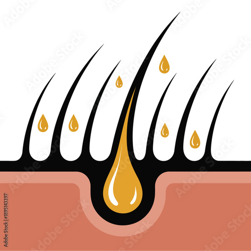 An illustration of hair follicles with oil droplets on a white and pink background