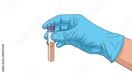 Medical professional wearing a blue protective glove holding a glass test tube containing a brown liquid sample for laboratory diagnostic testing.