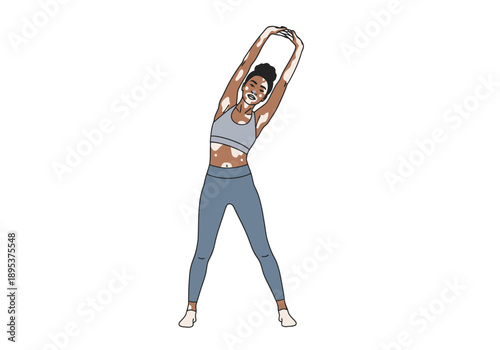 Woman with diverse skin condition stretching arms overhead during fitness activity in athletic apparel