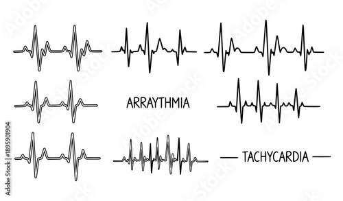 Hand-drawn heartbeat line vector set with ECG pulse doodle icons for cardiac health
