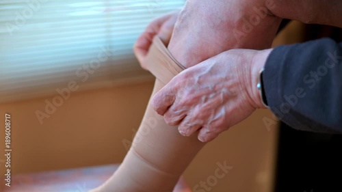 elderly man putting on a stocking for lymphedema