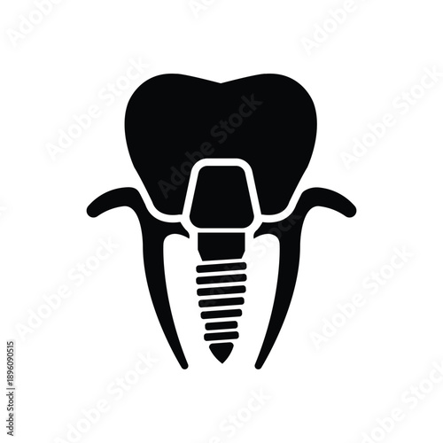 Dental Implant Icon Tooth Restoration Vector Illustration for Dentistry Care