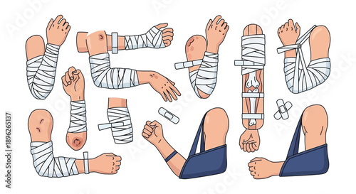 Anatomical illustrations of bandaged limbs and body parts depict injuries