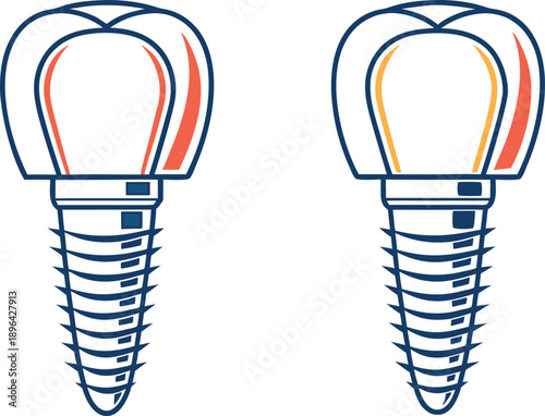 Medical Implant Design Illustration. Dental Implant Design Concept. Surgical Implant Medical Illustration. Orthopedic Implant Design Illustration. Healthcare Implant Medical Design. Modern Medical Imp
