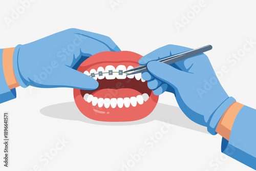 Dentist applying braces on model jaw, providing expert orthodontic dental care