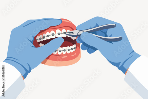 Orthodontist hands adjusting dental braces on a jaw model for teeth alignment