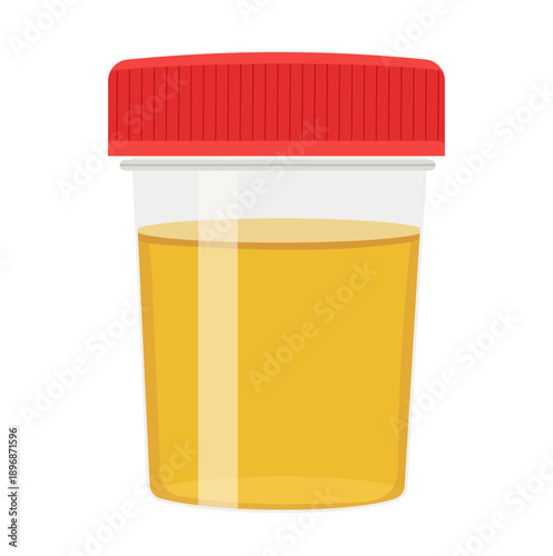 Plastic Test Tube with Urine Test or Urine Sample Illustration Isolated on White Background