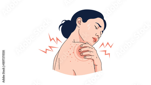 Woman scratching her itchy shoulder showing red spots and a rash representing an allergic reaction or skin condition.