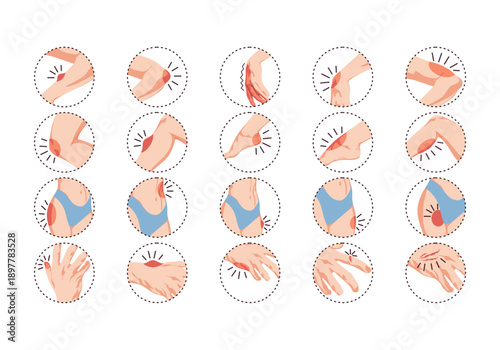 Disease Clarity Illustration