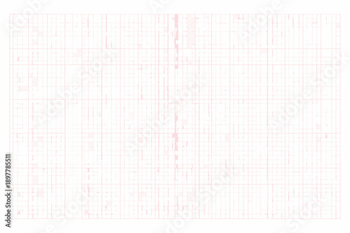 Electrocardiogram showing a single abnormal heart rhythm spike