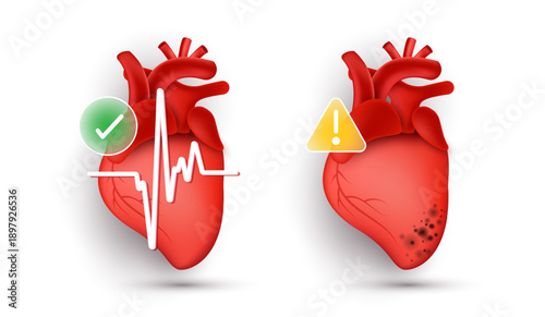 Healthy vs unhealthy human heart anatomy comparison with heartbeat ECG line, green check mark and yellow warning alert sign. Vector illustration for cardiology, medical diagnosis and risk concept.