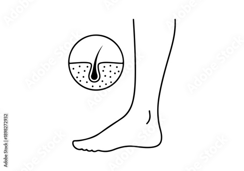 Illustration of a human leg with close-up view of hair follicle and skin pores, medical and beauty concept