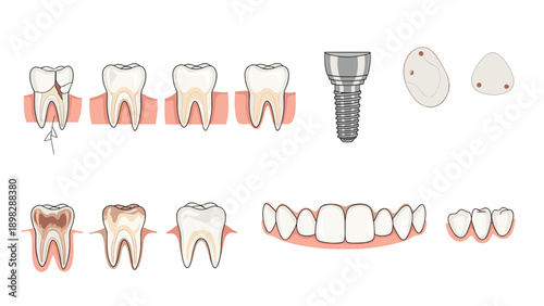 Comprehensive set of dental health illustrations including teeth, implants, crowns, and common dental procedures.