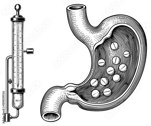 Medical diagram showing stomach interior with pills, gastric lining, and pH meter for acid measurement, digestive system, absorption.