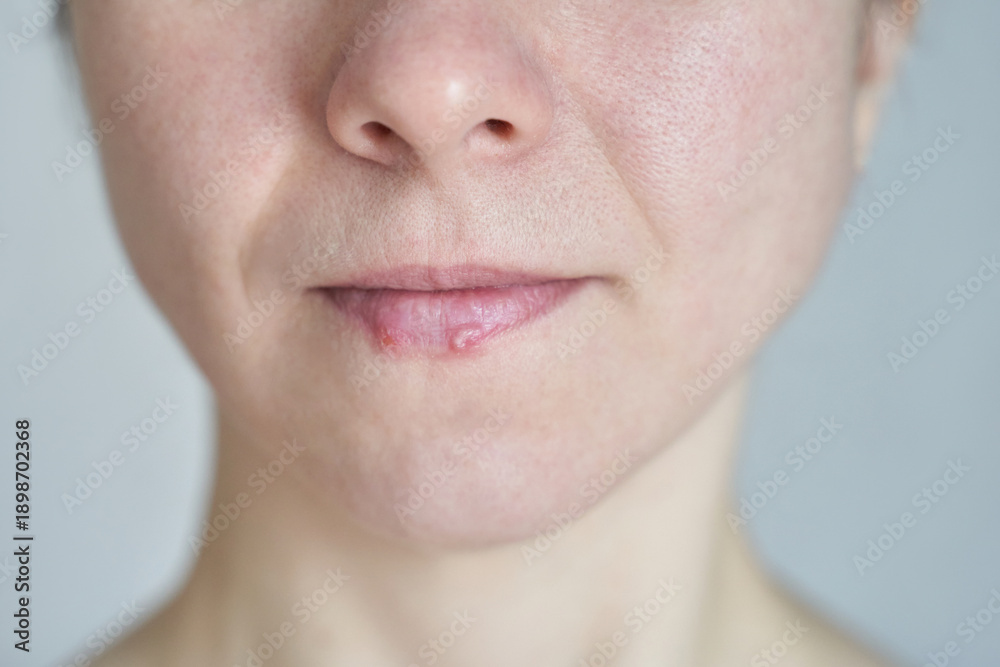 Obraz premium Close-up of mature caucasian female with chapped lips and natural skin texture highlighting beauty and skincare concerns.