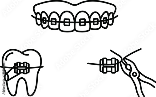 Orthodontic braces on human teeth for dental alignment illustration