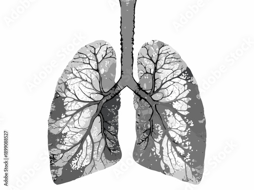 Anatomical illustration of human lungs showcasing branching airways