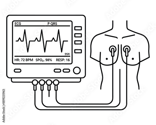 Ecg display with attached sensors showing vitals like heart rate and oxygen level of patient