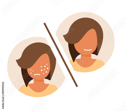 Acne skincare before after treatment icon modern, allergy irritation woman face skin care hygiene transformation results effect, cosmetic facial dermatology healing, pimple medical therapy comparison