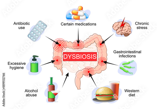 Dysbiosis. Potential causes of dysbacteriosis