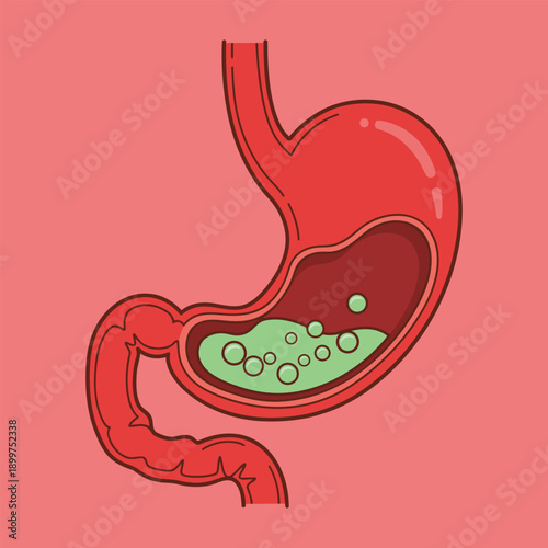 Stomach Acid Reflux Gastric Problem Vector Illustration