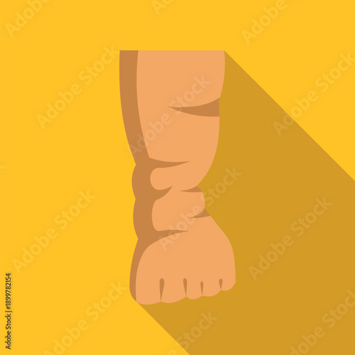 Human leg swelling from a medical condition like edema