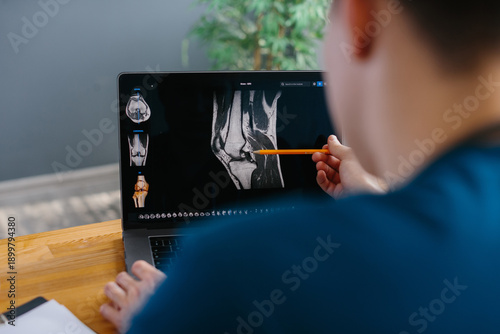 Doctor analyzing knee mri scan diagnosis on laptop