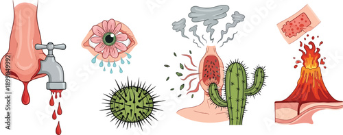 Medical illustration showing common allergy symptoms and irritation triggers with metaphors for pain and itch