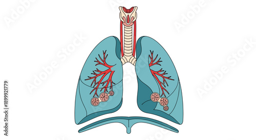 Anatomical Illustration of Human Lungs with Bronchi and Alveoli